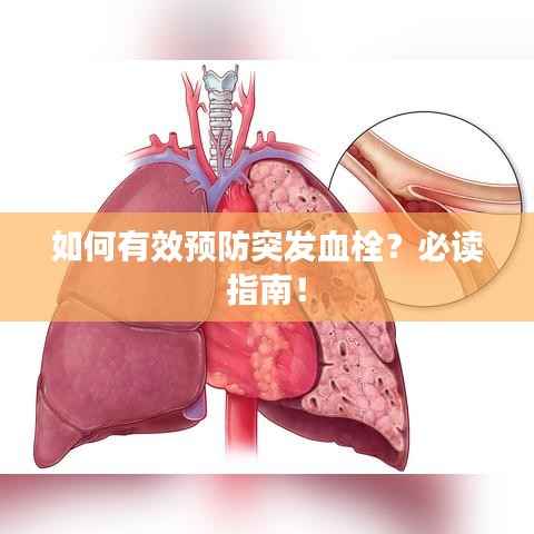 如何有效预防突发血栓?必读指南!